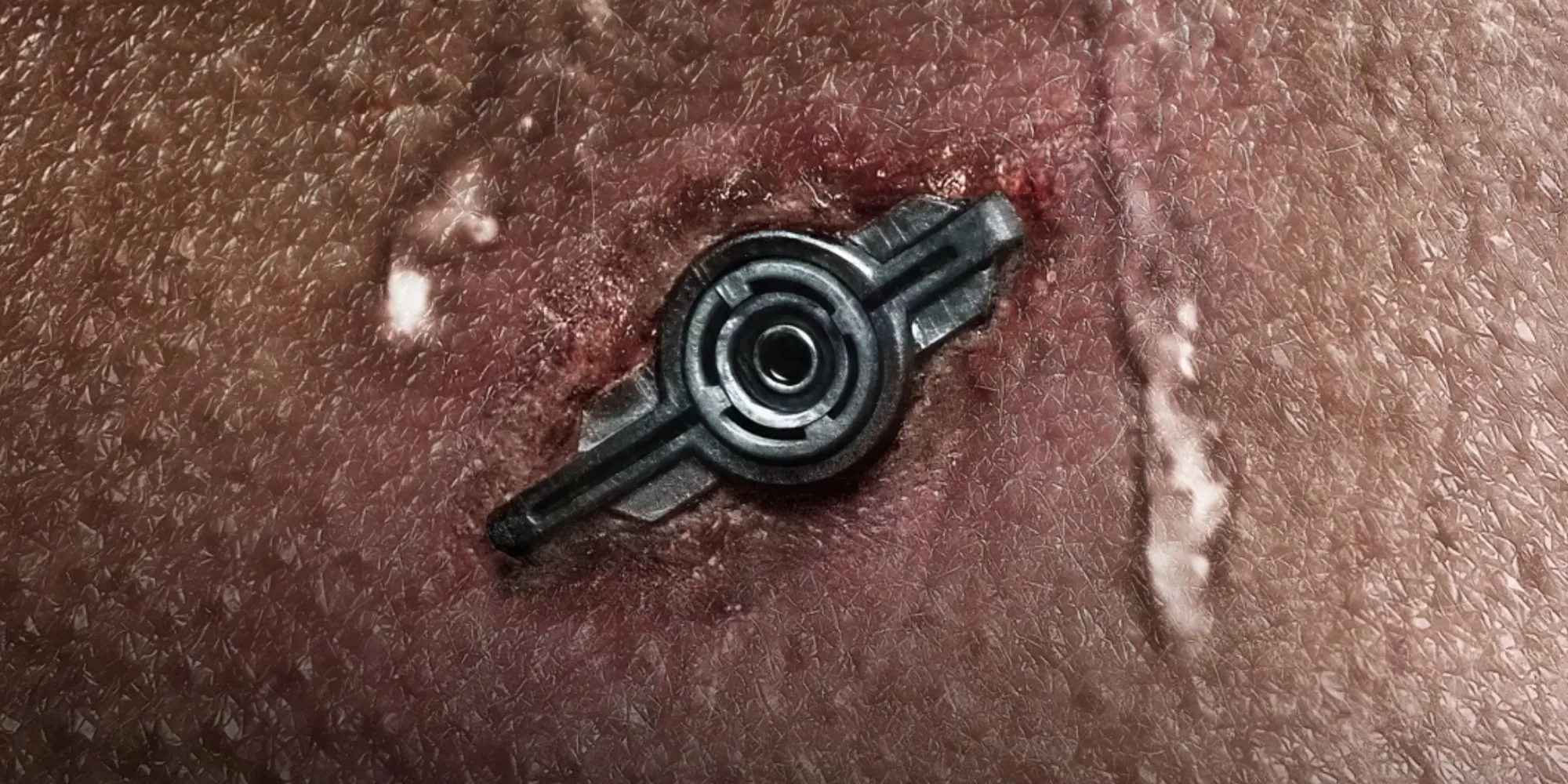 neuromancer-4 | film.org.pl Close-up of a circular medical implant embedded in reddened skin, with surrounding irritation and minor bleeding on brown skin.